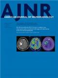 AMERICAN JOURNAL OF NEURORADIOLOGY�s־���п�Ժ�ׅ^(q��)